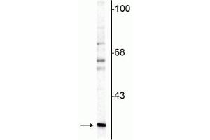Image no. 2 for anti-Calbindin 2 (CALB2) antibody (ABIN361372)