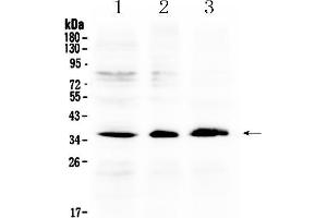 Image no. 2 for anti-Aldo-Keto Reductase Family 1, Member B10 (Aldose Reductase) (AKR1B10) (AA 285-316), (C-Term) antibody (ABIN5518800)