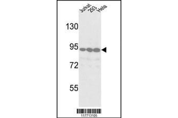 anti-Discoidin Domain Receptor tyrosine Kinase 2 (DDR2) antibody
