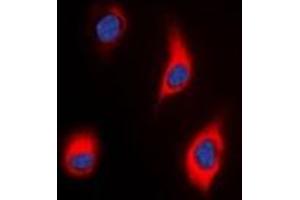 Image no. 3 for anti-Tensin 3 (TNS3) antibody (ABIN3222991)