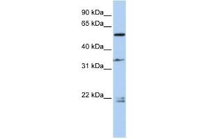 Image no. 1 for anti-Dihydropyrimidinase-Like 2 (DPYSL2) (Middle Region) antibody (ABIN2784711)