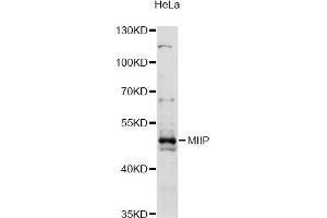 Image no. 1 for anti-Migration and Invasion Inhibitory Protein (MIIP) antibody (ABIN6293240)