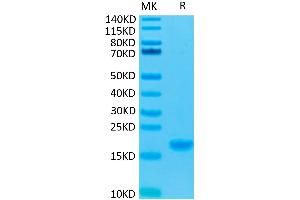 Image no. 3 for Interleukin 7 (IL7) protein (ABIN7274963)