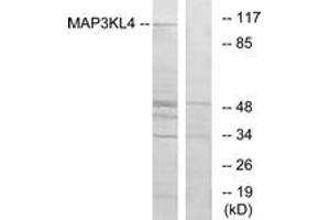 Image no. 1 for anti-Mitogen-Activated Protein Kinase Kinase Kinase MLK4 (KIAA1804) (AA 631-680) antibody (ABIN1533952)