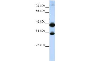 Image no. 1 for anti-Zinc Finger Protein 138 (ZNF138) (C-Term) antibody (ABIN2783046)