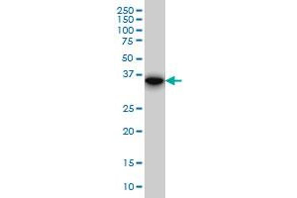 anti-Four and A Half LIM Domains 1 (FHL1) (AA 23-120) antibody