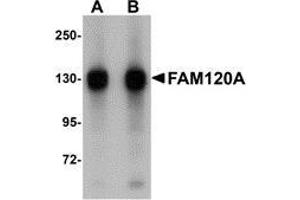 Image no. 2 for anti-Family with Sequence Similarity 120A (FAM120A) (Center) antibody (ABIN499822)