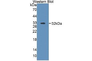 Image no. 1 for anti-ATP-Binding Cassette, Sub-Family B (MDR/TAP), Member 9 (ABCB9) (AA 500-762) antibody (ABIN5013190)