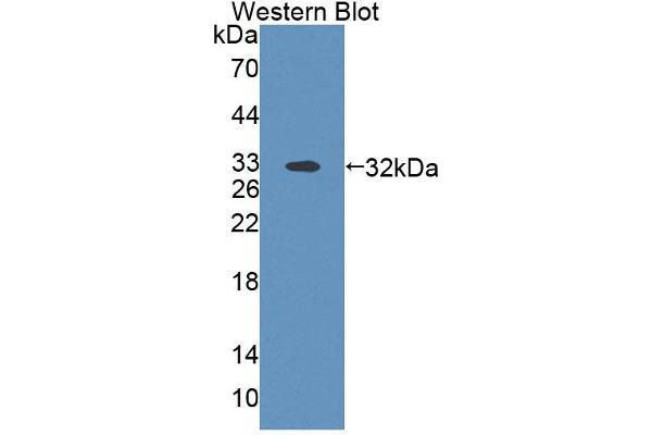 anti-ATP-Binding Cassette, Sub-Family B (MDR/TAP), Member 9 (ABCB9) (AA 500-762) antibody