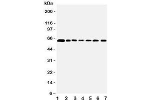 Image no. 1 for anti-Coactivator-Associated Arginine Methyltransferase 1 (CARM1) (Middle Region) antibody (ABIN3030541)