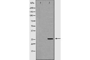 Image no. 2 for anti-Glutathione S-Transferase mu 2 (Muscle) (GSTM2) antibody (ABIN6262118)