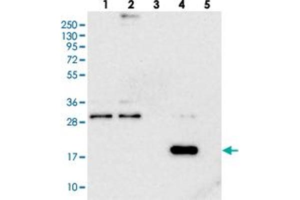 anti-RWD Domain Containing 4 (RWDD4) antibody