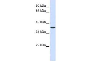 anti-Thioredoxin-Related Transmembrane Protein 2 (TMX2) (Middle Region) antibody