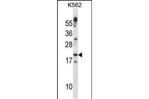 Image no. 1 for anti-Cardiotrophin 1 (CTF1) (AA 166-194), (C-Term) antibody (ABIN5530891)