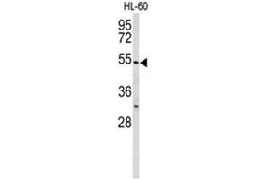 Image no. 3 for anti-Bactericidal/Permeability Increasing Protein (BPI) (AA 301-331), (Middle Region) antibody (ABIN950675)