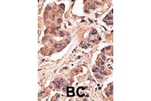 Image no. 2 for anti-Melanoma Antigen Family H, 1 (MAGEH1) (AA 186-218), (C-Term) antibody (ABIN390121)