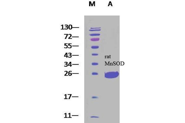 SOD2 Protein (partial) (His tag)