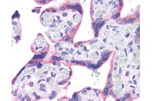 Image no. 4 for anti-Wilms Tumor 1 (WT1) (C-Term) antibody (ABIN604665)