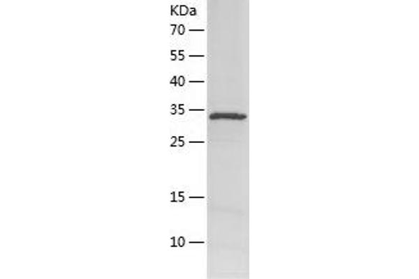 FNDC4 Protein (AA 45-148) (His tag)