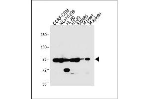 Image no. 7 for anti-Nucleotide-Binding Oligomerization Domain Containing 1 (NOD1) (AA 923-951), (C-Term) antibody (ABIN655750)