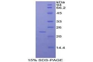 Image no. 1 for RAD54-Like 2 (RAD54L2) (AA 638-837) protein (His tag) (ABIN1877335)