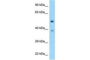 Image no. 1 for anti-tRNA-splicing Endonuclease Subunit SEN2 (TSEN2) (AA 395-444) antibody (ABIN6748165)