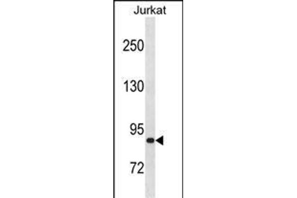 ZNF337 antibody  (C-Term)