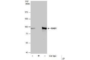 Image no. 2 for anti-Proteasome (Prosome, Macropain) 26S Subunit, Non-ATPase, 14 (PSMD14) (Center) antibody (ABIN2856031)