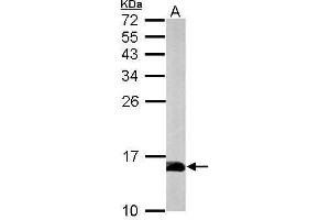 Image no. 1 for anti-Profilin 2 (PFN2) (Center) antibody (ABIN2856620)
