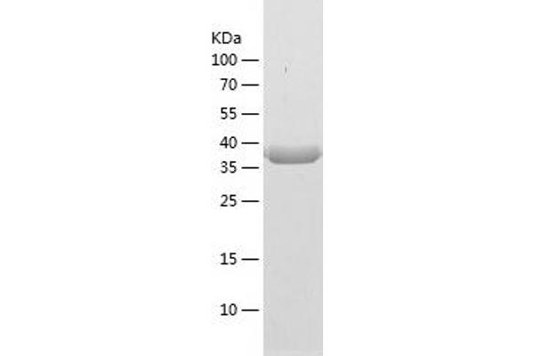 PECI/ECI2 Protein (AA 31-394) (His tag)