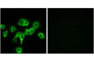 anti-Cell Adhesion Molecule-Related/down-Regulated By Oncogenes (CDON) (AA 511-560) antibody