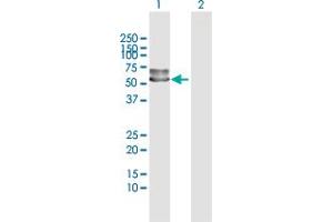 Image no. 2 for anti-Alpha2 Antiplasmin (SERPINF2) (AA 1-491) antibody (ABIN948271)