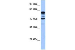 Image no. 1 for anti-Family with Sequence Similarity 46, Member C (FAM46C) (Middle Region) antibody (ABIN632520)