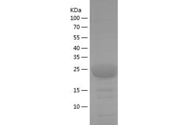 PPP2R2A Protein (AA 71-107) (His-IF2DI Tag)