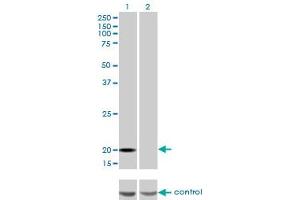 Image no. 4 for anti-Ferritin, Light Polypeptide (FTL) (AA 1-175) antibody (ABIN947883)