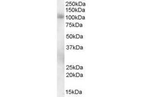 Image no. 1 for anti-phosphodiesterase 5A, cGMP-Specific (PDE5A) (C-Term) antibody (ABIN185350)