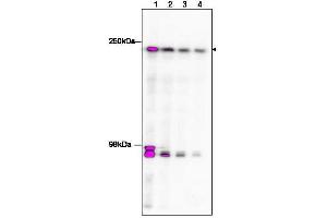 Image no. 4 for anti-TAF1 RNA Polymerase II, TATA Box Binding Protein (TBP)-Associated Factor, 250kDa (TAF1) (C-Term) antibody (ABIN233826)