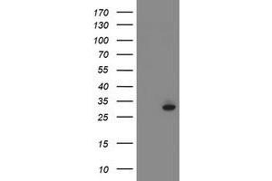 Image no. 11 for anti-Signal Recognition Particle Receptor, B Subunit (SRPRB) antibody (ABIN1501126)