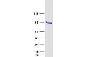 Image no. 1 for Stromal Membrane Associated Protein 1 (SMAP1) (Transcript Variant 1) protein (Myc-DYKDDDDK Tag) (ABIN2732231)