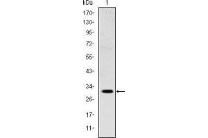 Image no. 1 for anti-Msh Homeobox 1 (MSX1) antibody (ABIN969296)