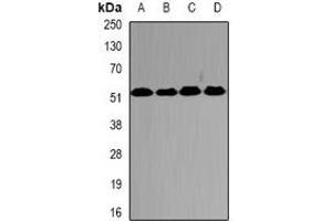 Image no. 3 for anti-Proteasome (Prosome, Macropain) 26S Subunit, ATPase, 2 (PSMC2) antibody (ABIN2966948)