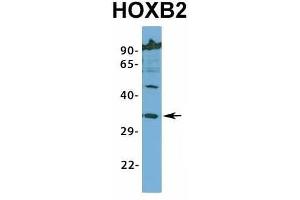 Image no. 3 for anti-Homeobox B2 (HOXB2) (N-Term) antibody (ABIN2776384)