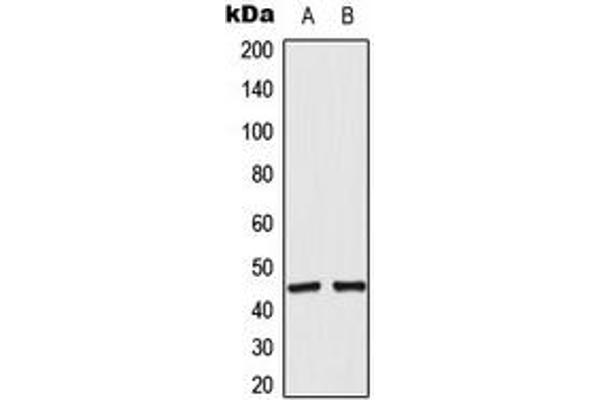 anti-Acyl-CoA Thioesterase 4 (ACOT4) (C-Term) antibody