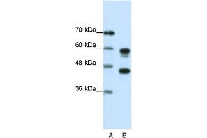 Image no. 4 for anti-Proteasome (Prosome, Macropain) 26S Subunit, ATPase, 5 (PSMC5) (C-Term) antibody (ABIN2780449)