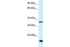 Image no. 1 for anti-Kruppel-Like Factor 3 (Basic) (KLF3) (C-Term) antibody (ABIN2781014)