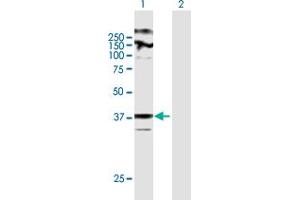 Image no. 1 for anti-Zinc Finger, DHHC-Type Containing 23 (ZDHHC23) (AA 1-409) antibody (ABIN949922)
