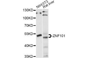 Image no. 1 for anti-Zinc Finger Protein 101 (ZNF101) antibody (ABIN6293896)
