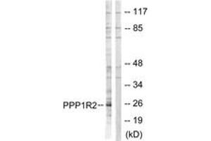 Image no. 1 for anti-Protein Phosphatase 1, Regulatory (Inhibitor) Subunit 2 (PPP1R2) (AA 86-135) antibody (ABIN1532721)