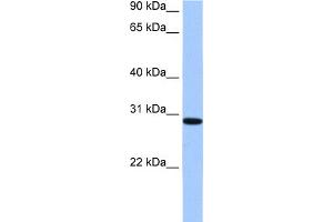 Image no. 1 for anti-RALY RNA Binding Protein-Like (RALYL) (C-Term) antibody (ABIN2776665)