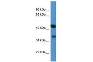 Image no. 1 for anti-ArfGAP with Dual PH Domains 1 (ADAP1) (AA 228-277) antibody (ABIN6746347)